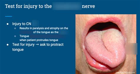 tongue tear results